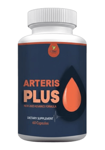 Arteris Plus